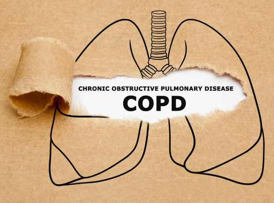 The Silent Threat: COPD and Air Pollution